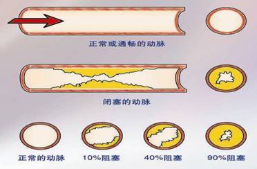 血管
