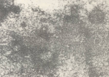 猪瘟病毒粒子
