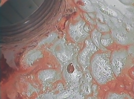 VJ 内窥镜表面检查