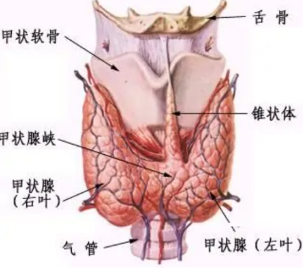 T3型甲亢结构图