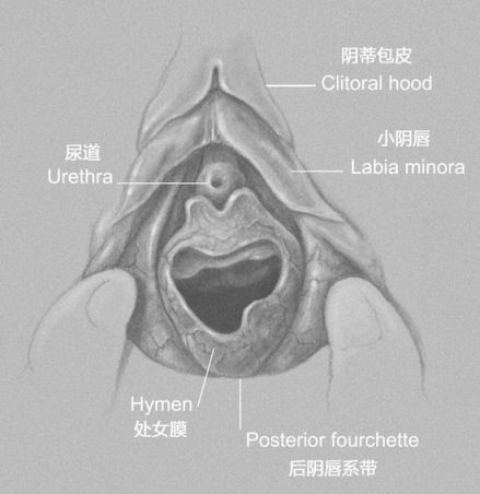 处女膜示意图