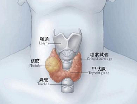 甲状腺滤泡腔