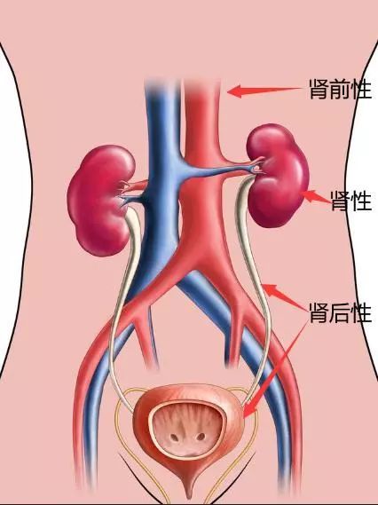 肾前性