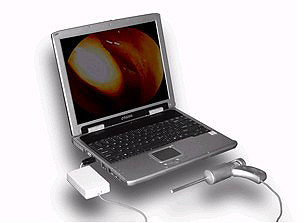 LED电子医疗内窥镜