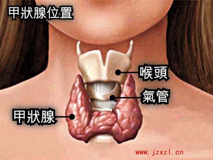 甲状腺增生
