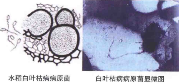 水稻白叶枯病原细菌
