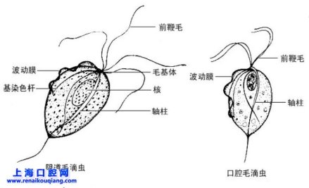 辨别口腔毛滴虫与阴道毛滴虫