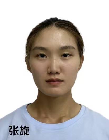 张旋
