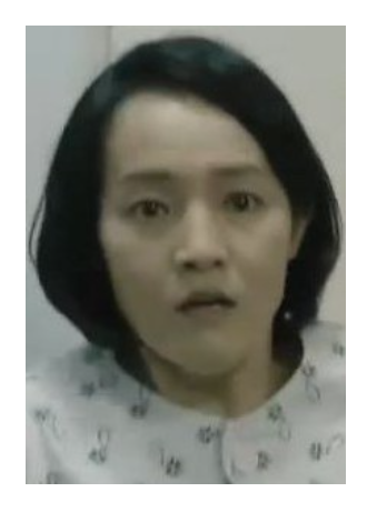 金兰熙